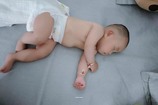 蚌埠六个月宝宝眼睛散光